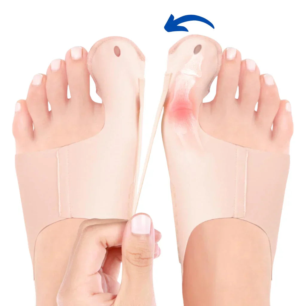 Hallux Valgus Sokker Med Justerbare Stropper Til Komfortabel Pasform
